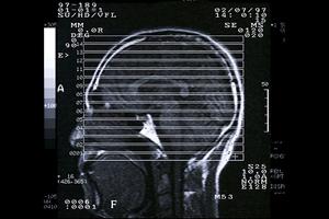 山形で安心して膀胱炎治療をするなら