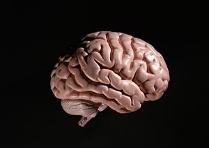 通販でも購入できる医療ウィッグ